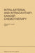 Intra-Arterial and Intracavitary Cancer Chemotherapy: Proceedings of the Conference on Intra-Arterial and Intracavitary Chemotheraphy, San Diego, Cali by Stephen B. Howell