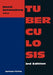 Tuberculosis by David Schlossberg