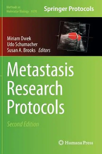 Metastasis Research Protocols by Miriam Dwek