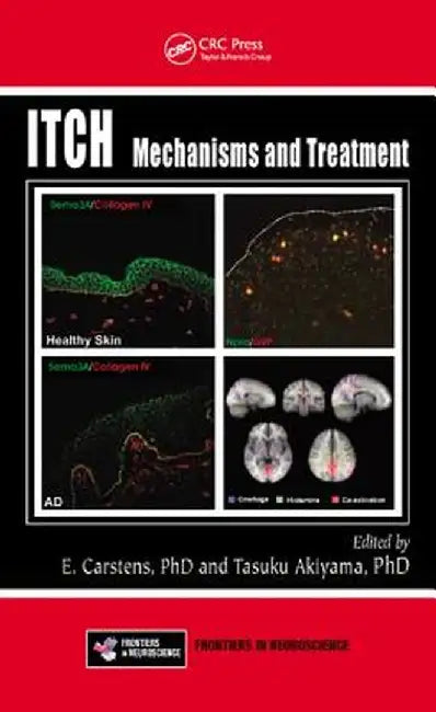 Itch: Mechanisms and Treatment by E. Carstens