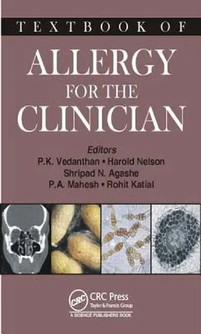 Textbook of Allergy for the Clinician by Pudupakkam K. Vedanthan