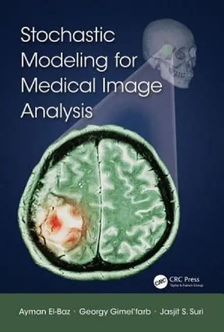 Stochastic Modeling for Medical Image Analysis by Ayman El-Baz