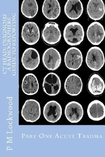 CT Head: DIAGNOSIS A Radiographers Guide To Reporting Part 1 Acute Trauma: Part One Acute Trauma by P. M. Lockwood