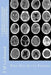 CT Head: DIAGNOSIS A Radiographers Guide To Reporting Part 1 Acute Trauma: Part One Acute Trauma by P. M. Lockwood