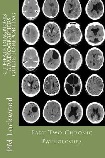 CT Head: DIAGNOSIS A Radiographers Guide To Reporting Part 2 Chronic Pathologies: Part 2 Chronic Pathologies by P. M. Lockwood