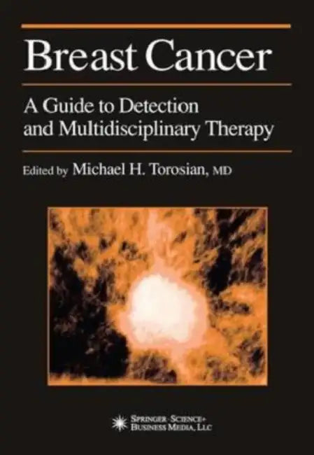 Breast Cancer: A Guide to Detection and Multidisciplinary Therapy by Yrsa Sigurdardottir