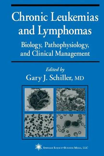 Chronic Leukemias and Lymphomas: Biology, Pathophysiology, and Clinical Management by Gary J. Schiller