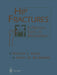 Hip Fractures: A Practical Guide to Management by Kenneth Koval