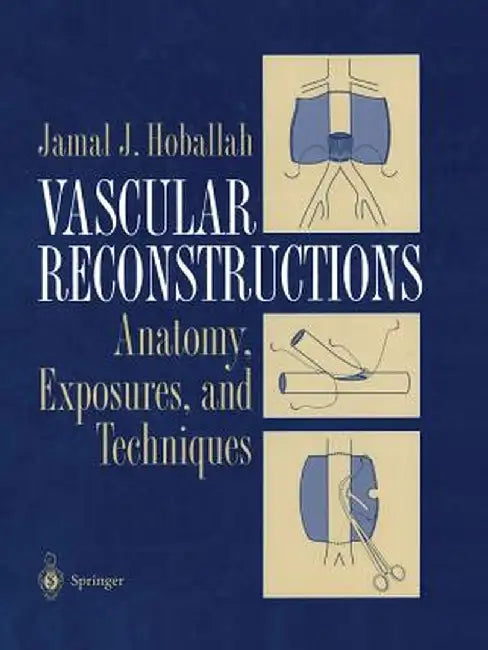Vascular Reconstructions: Anatomy, Exposures and Techniques by Jamal J. Hoballah