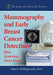 Mammography and Early Breast Cancer Detection: How Screening Saves Lives by Alan B. Hollingsworth