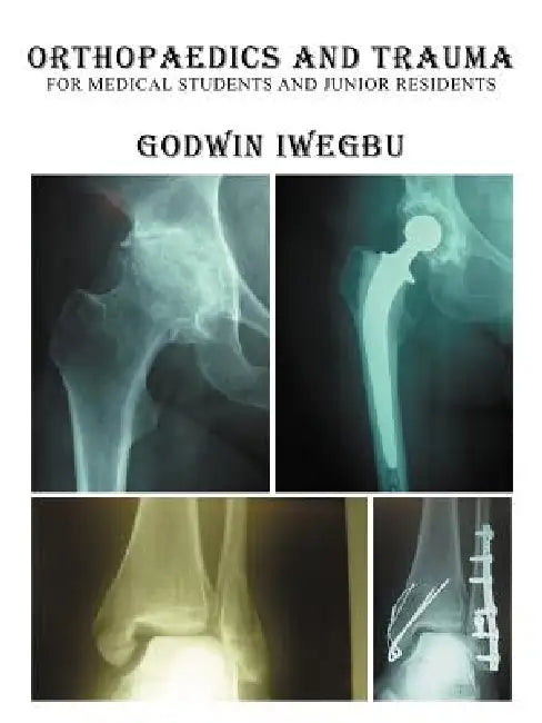 Orthopaedics and Trauma for Medical Students and Junior Residents by Godwin Iwegbu