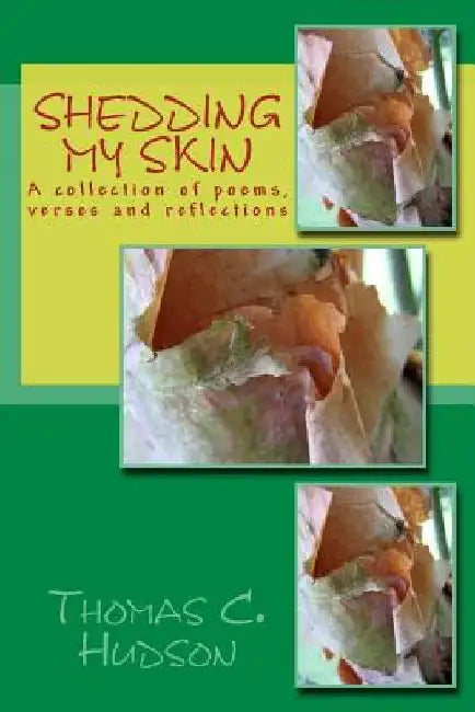 Shedding My Skin by Thomas Hudson