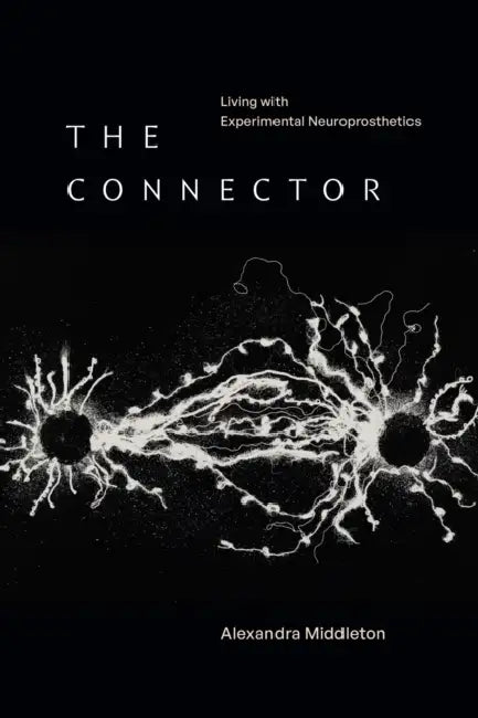 The Connector: Living with Experimental Neuroprosthetics by Alexandra Middleton