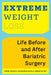 Extreme Weight Loss: Life Before and After Bariatric Surgery by Sarah Trainer