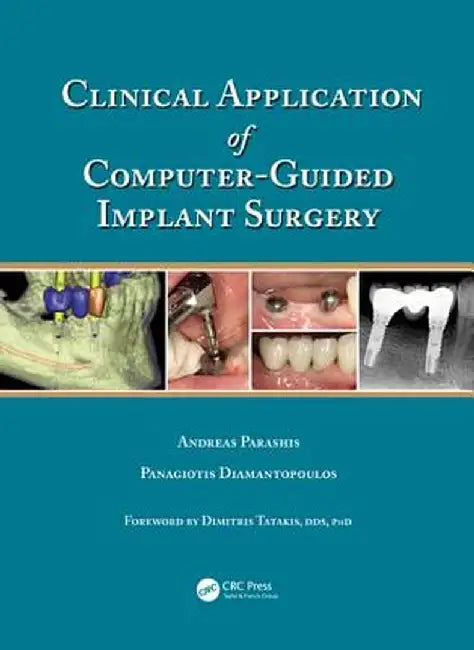 Clinical Application of Computer-Guided Implant Surgery by Andreas Parashis
