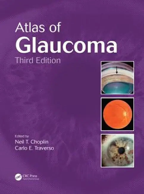 Atlas of Glaucoma by Neil T. Choplin