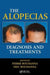 The Alopecias: Diagnosis and Treatments by Pierre Bouhanna