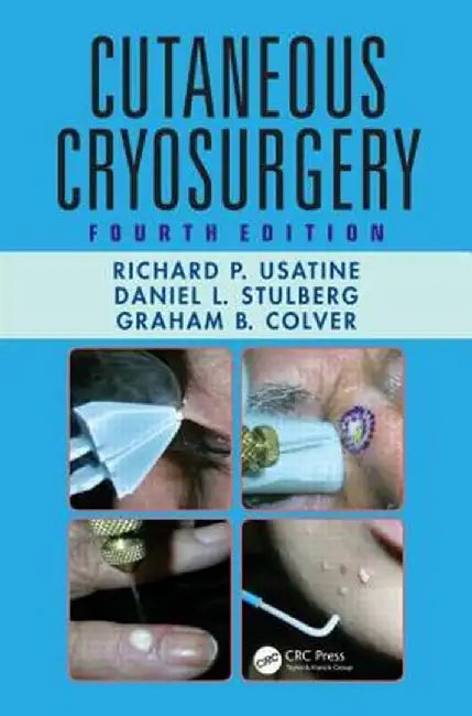 Cutaneous Cryosurgery by Richard P. Usatine