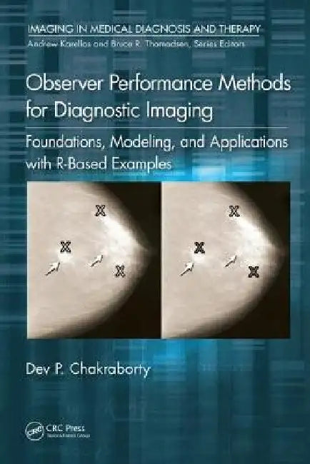Observer Performance Methods for Diagnostic Imaging: Foundations, Modeling, and Applications with R-Based Examples by Dev P. Chakraborty