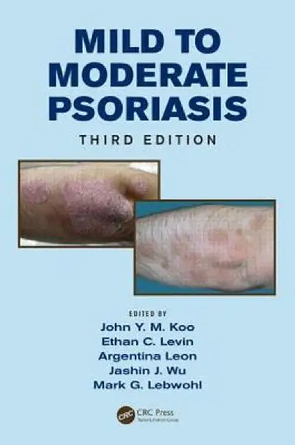 Mild to Moderate Psoriasis by John Koo
