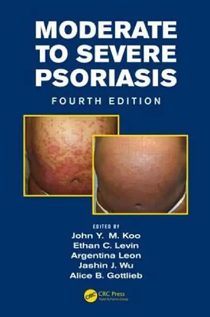 Moderate to Severe Psoriasis by John Koo