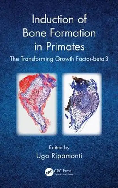 Induction of Bone Formation in Primates: The Transforming Growth Factor-Beta 3 by Ugo Ripamonti