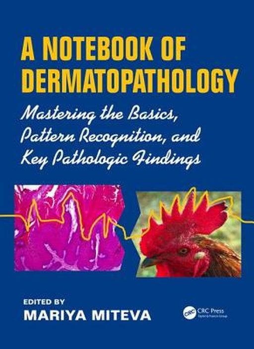 A Notebook of Dermatopathology: Mastering the Basics, Pattern Recognition, and Key Pathologic Findings by Mariya Miteva