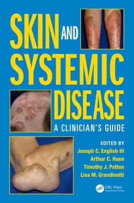 Skin and Systemic Disease: A Clinician's Guide by Joseph C. English III
