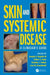 Skin and Systemic Disease: A Clinician's Guide by Joseph C. English III