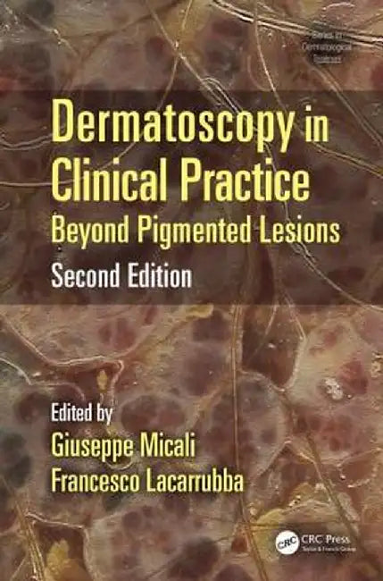Dermatoscopy in Clinical Practice: Beyond Pigmented Lesions by Giuseppe Micali