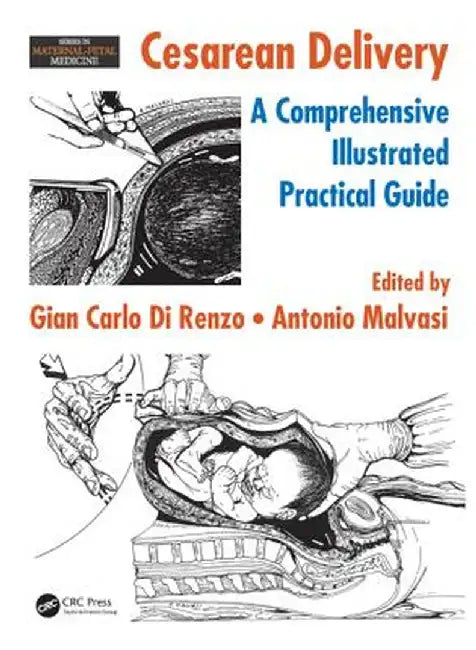 Cesarean Delivery: A Comprehensive Illustrated Practical Guide by Gian Carlo Di Renzo