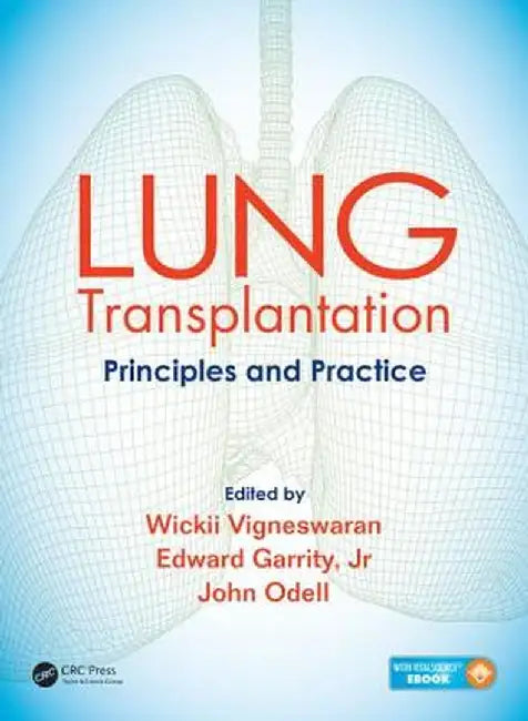 Lung Transplantation: Principles and Practice by Wickii Vigneswaran