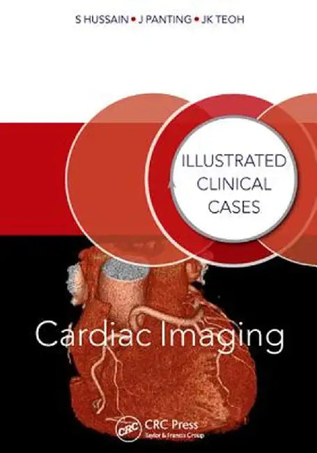 Cardiac Imaging: Illustrated Clinical Cases by Shahid Hussain