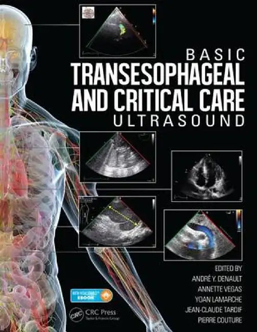 Basic Transesophageal and Critical Care Ultrasound by André Denault