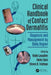 Clinical Handbook of Contact Dermatitis: Diagnosis and Management by Body Region by Robin Lewallen