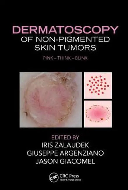 Dermatoscopy of Non-Pigmented Skin Tumors: Pink-Think-Blink by Iris Zalaudek