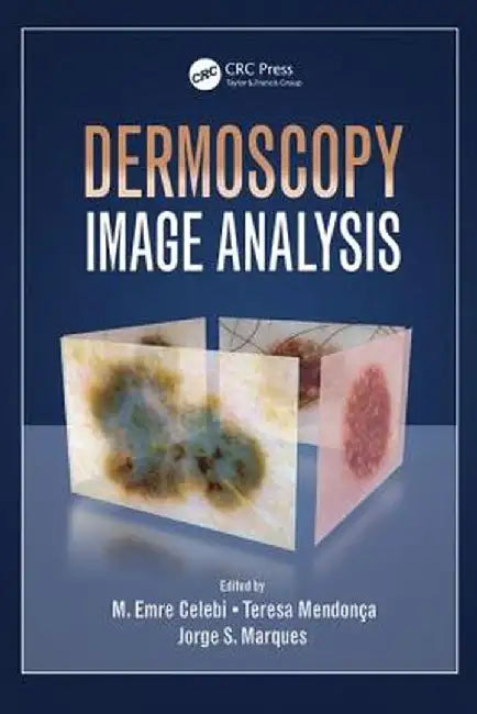 Dermoscopy Image Analysis by M. Emre Celebi