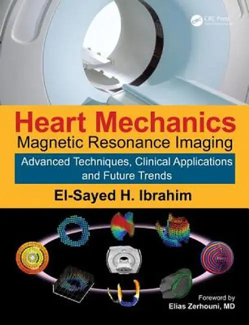 Heart Mechanics: Magnetic Resonance Imaging--Advanced Techniques, Clinical Applications, and Future Trends by El-Sayed H. Ibrahim