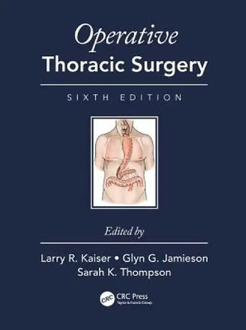 Operative Thoracic Surgery by Larry R. Kaiser