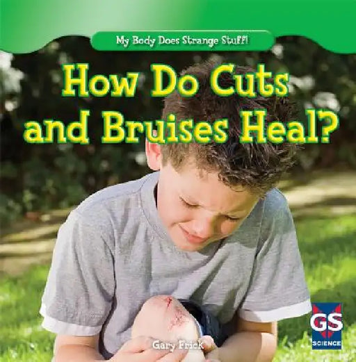 How Do Cuts and Bruises Heal? by Gary Frick