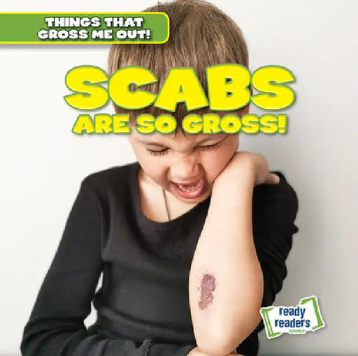Scabs Are So Gross! by Lynda Arnez
