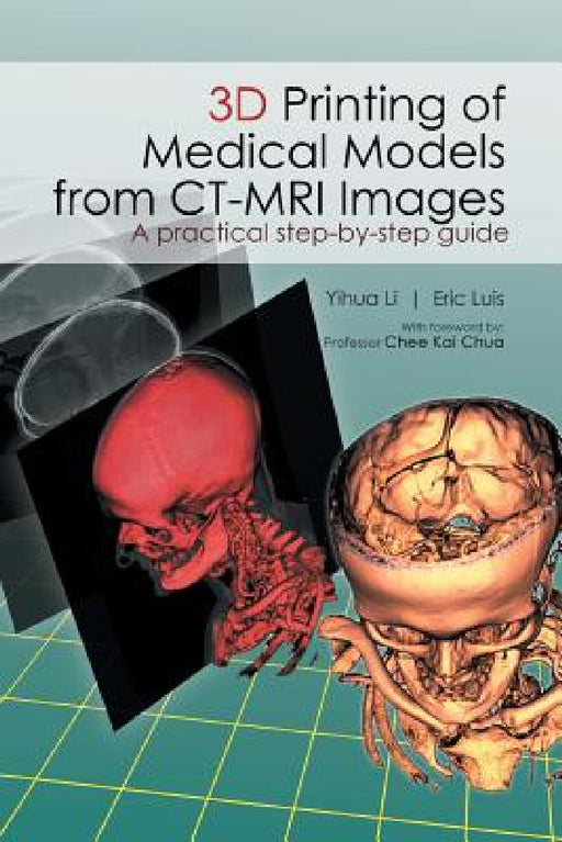 3D Printing of Medical Models from CT-MRI Images: A Practical step-by-step guide by Li Yihua, Eric Luis