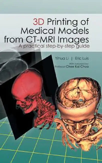3D Printing of Medical Models from CT-MRI Images: A Practical step-by-step guide by Li Yihua, Eric Luis