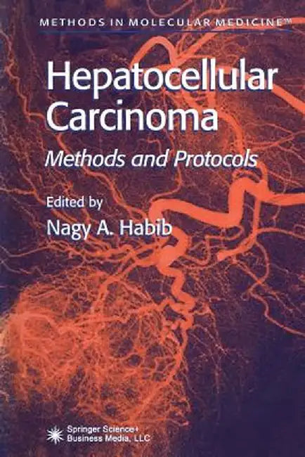 Hepatocellular Carcinoma: Methods and Protocols by Nagy A. Habib