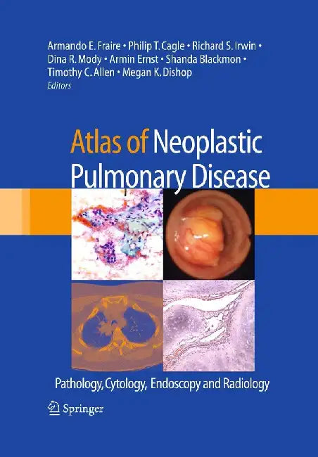Atlas of Neoplastic Pulmonary Disease: Pathology, Cytology, Endoscopy and Radiology by Armando E. Fraire