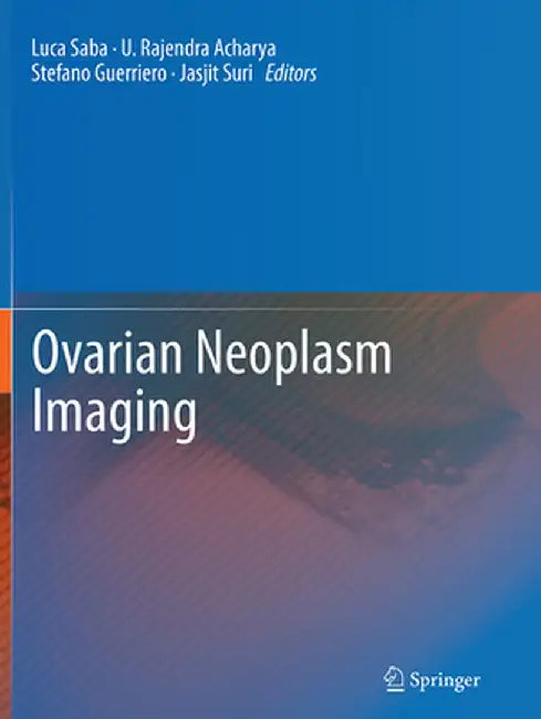 Ovarian Neoplasm Imaging by Luca Saba