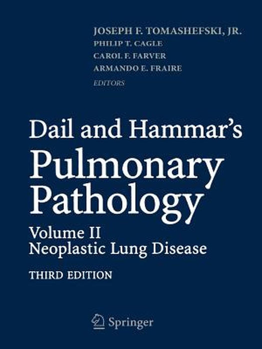 Dail and Hammar's Pulmonary Pathology: Volume II: Neoplastic Lung Disease by Joseph F. Tomashefski