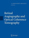 Retinal Angiography and Optical Coherence Tomography by J. Fernando Arévalo