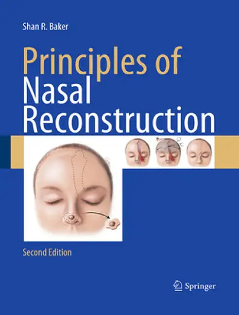 Principles of Nasal Reconstruction by Shan R. Baker