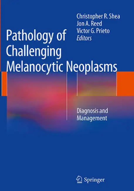 Pathology of Challenging Melanocytic Neoplasms: Diagnosis and Management by Christopher R. Shea